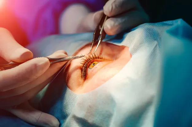 Procedimento médico detalhado em cirurgia de estrabismo.