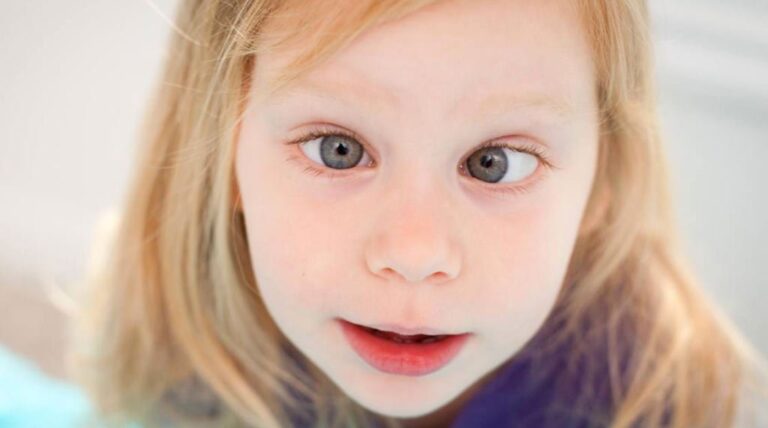 Estrabismo convergente em crianças